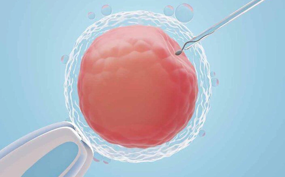 ICSI Treatment