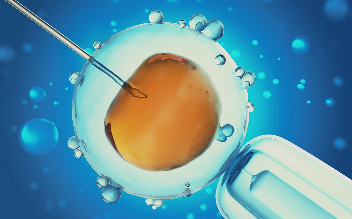 IVF Treatment