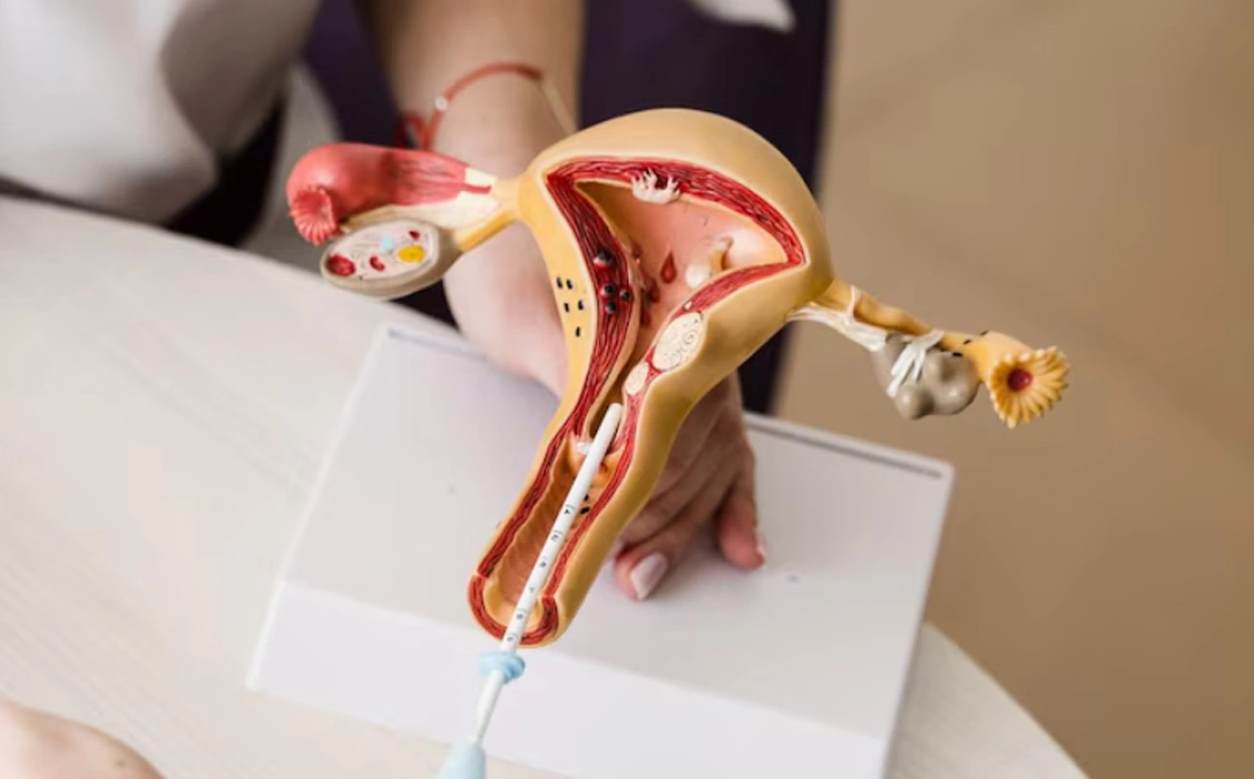 Ovulation Induction